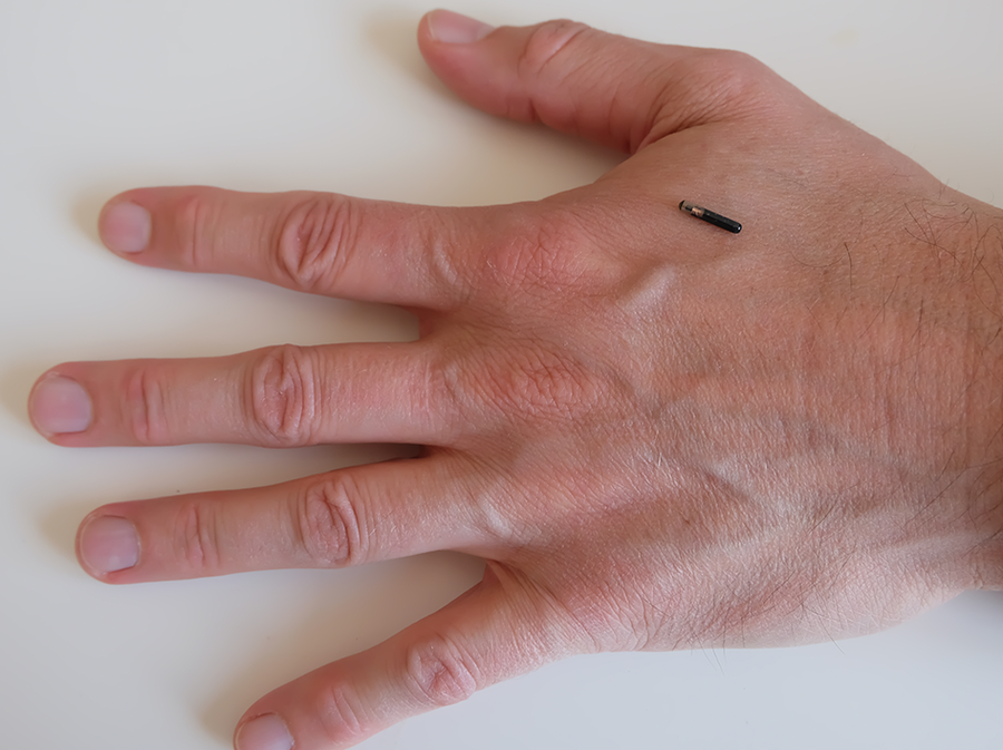The transponder chip is placed under the skin.